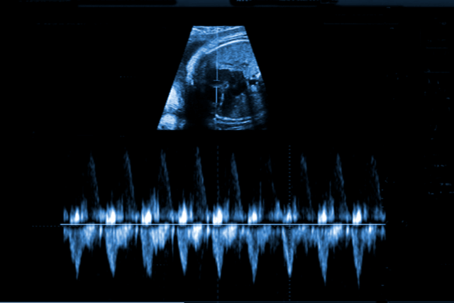 Fetal Heart Rate And Gestational Age Chart